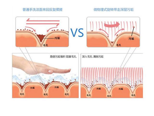 美容仪到底管用吗（揭秘美容仪黑幕）(16)